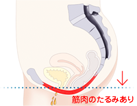 表面の汚れ